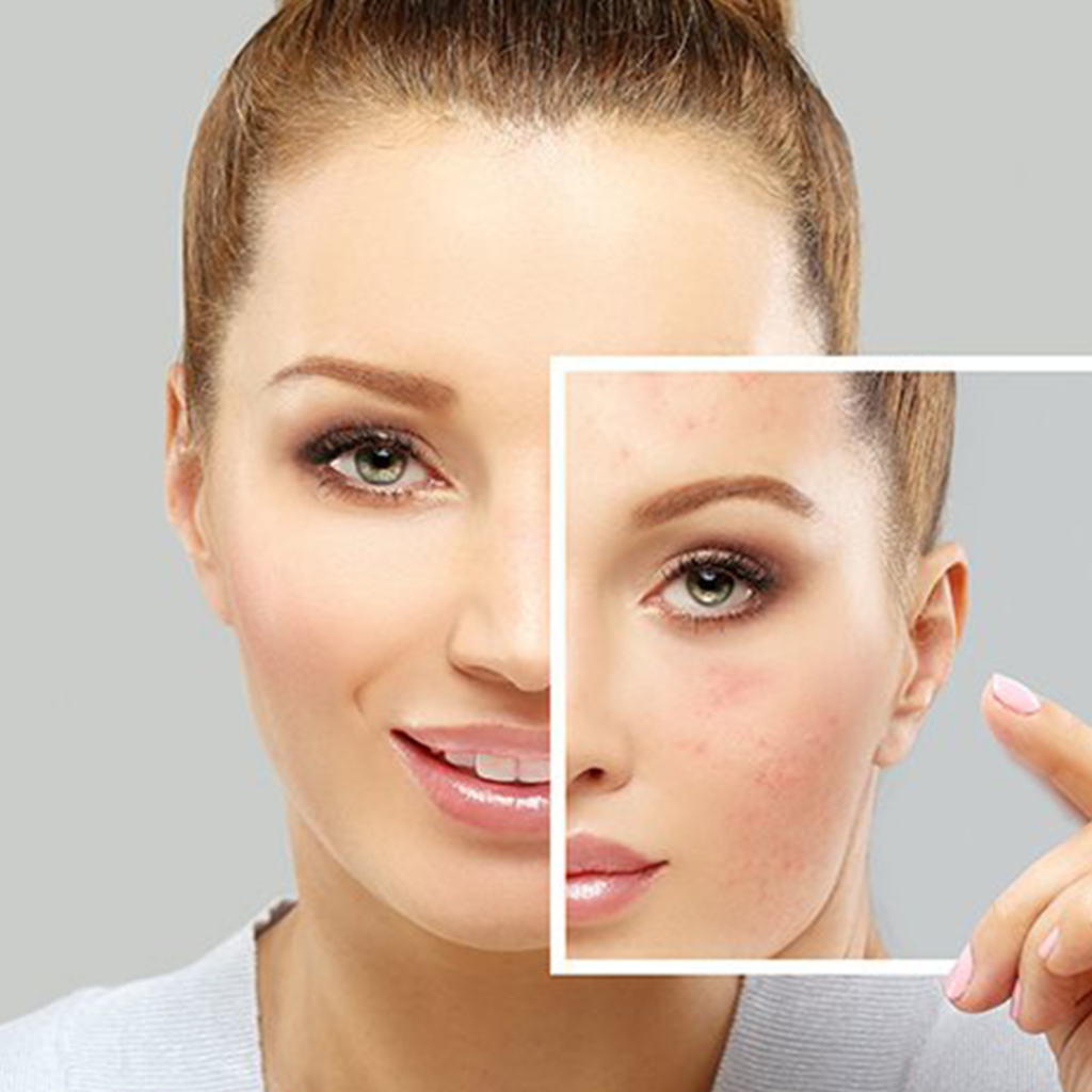 Skin Rejuvenation Treatment in Varanasi, India - Skin Rejuvenation