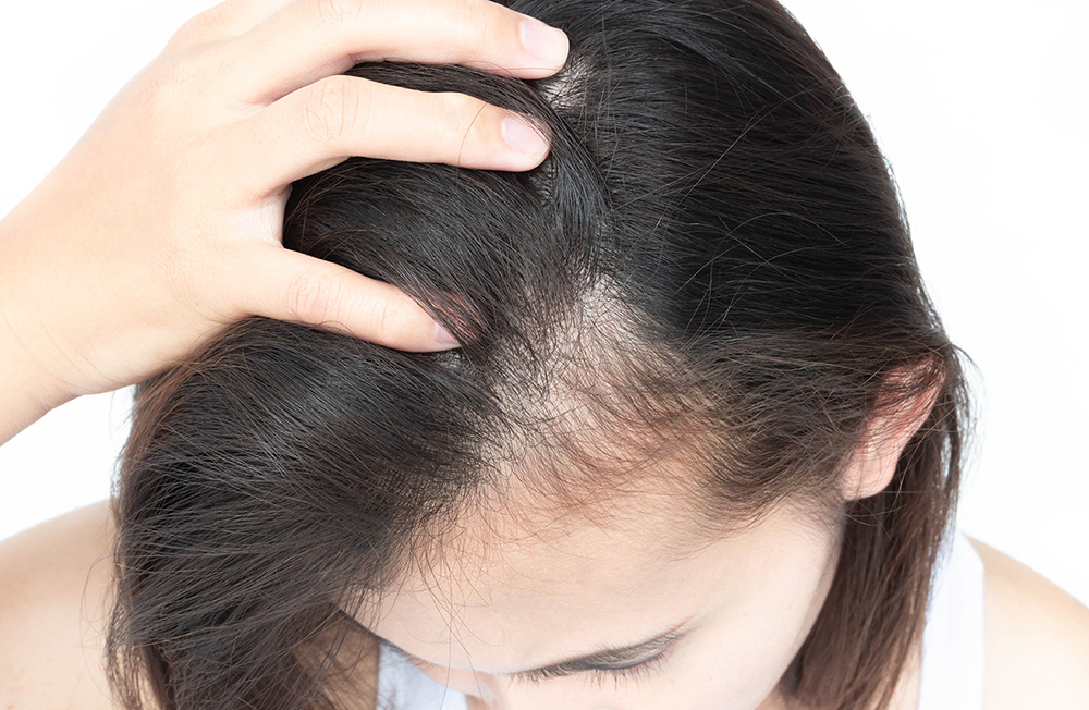Hair Loss & Hair Fall Treatment in Varanasi, India - Causes of Hair Loss